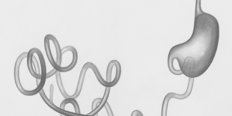 Nature’s Answer to Reflux: Understanding Alginate Therapy